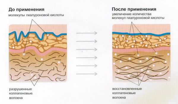 Взяли реванш