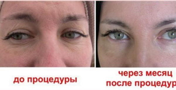 Магия преображения - PR