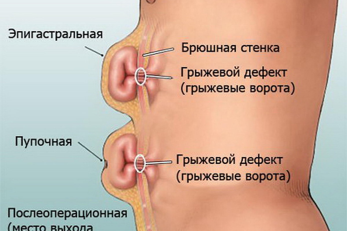 Не надорвитесь! - PR