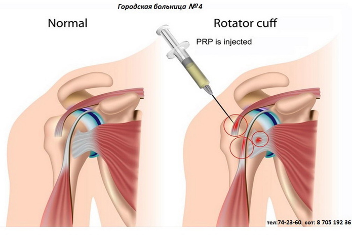 Здоровье ваших ног - PR