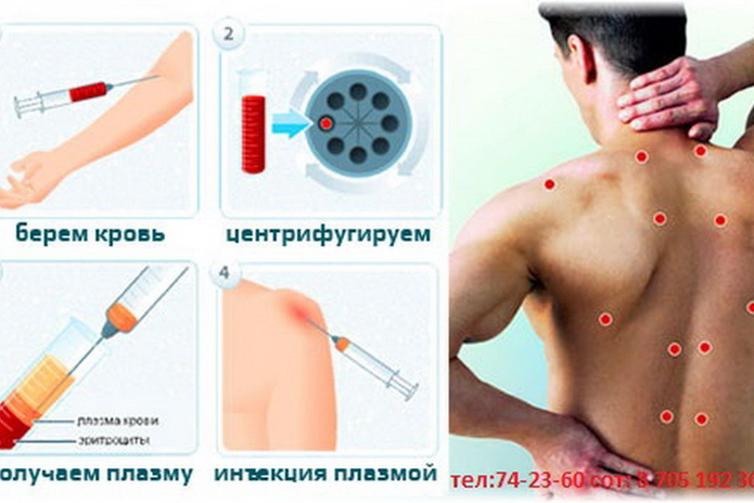 Здоровье ваших ног - PR