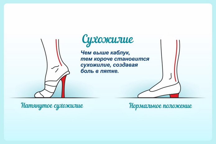 Красивые ножки – всегда - PR