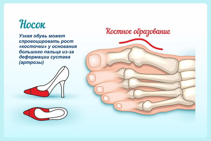 Красивые ножки – всегда - PR
