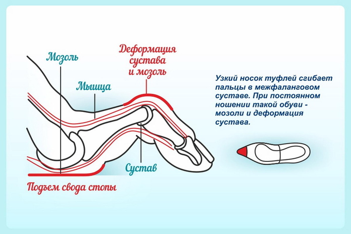 Красивые ножки – всегда - PR