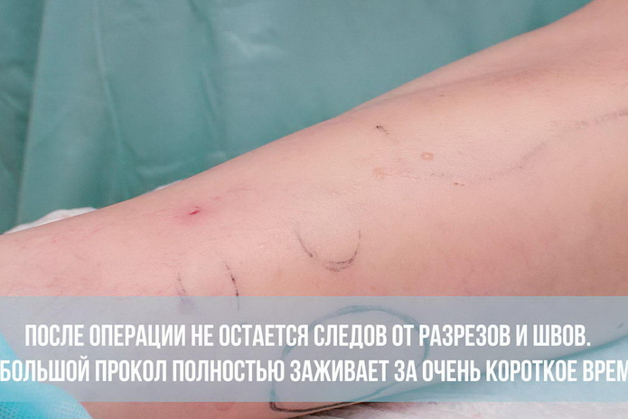 Золотой стандарт – PR