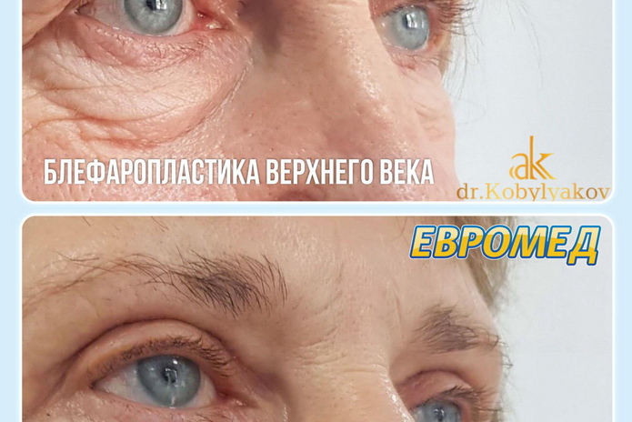 Безопасный метод липоскульптинга в Усть-Каменогорске! - PR
