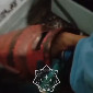 В ВКО ребенок застрял ногой в газовом баллоне