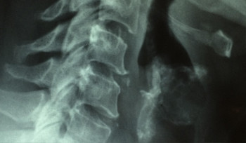 Пищевод, голову и шею проверят в Онкоцентре у жителей ВКО